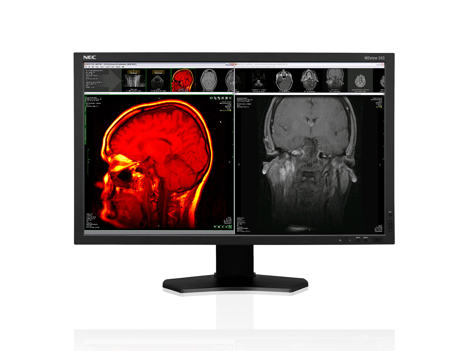 NEC MDview 243