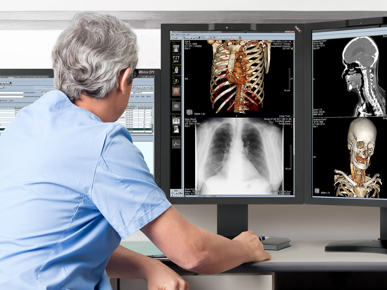 GammaCompMD QA